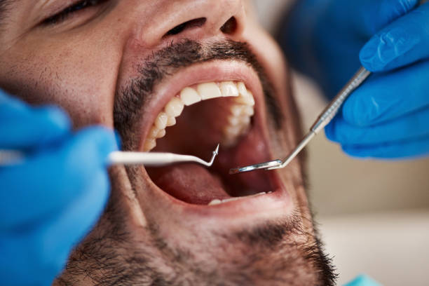 Oral Surgery in Sebastian, FL